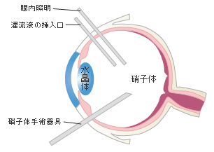 眼球